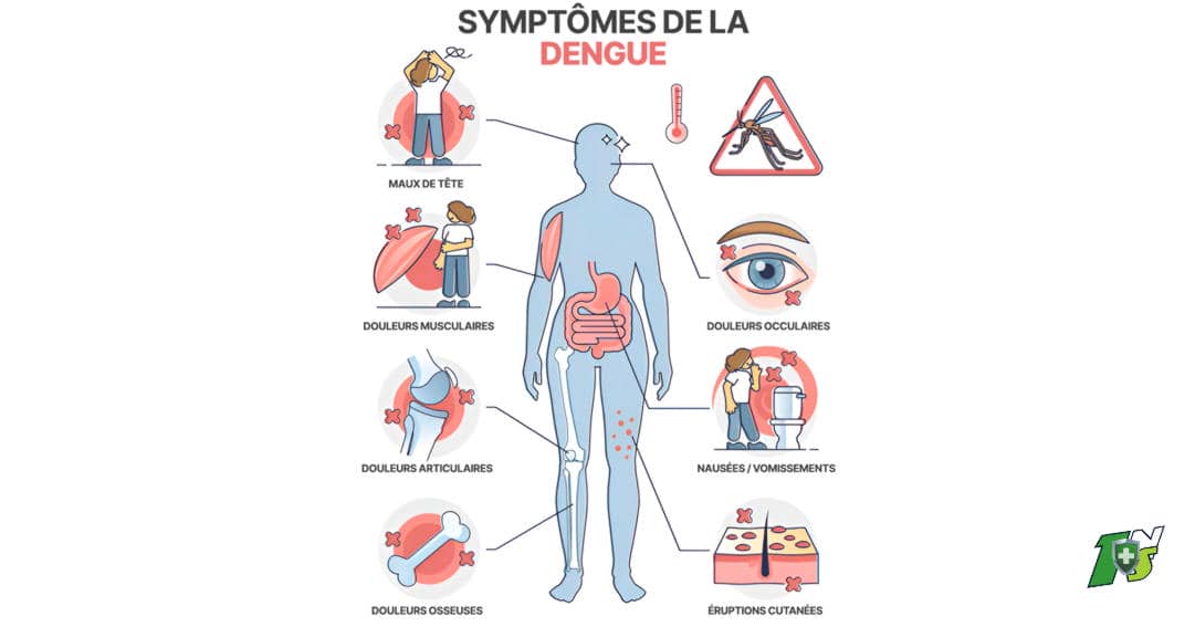 1nuisible1solution.com Dengue Symptômes