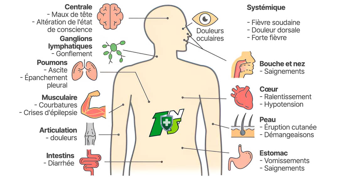 1nuisible1solution.com Dengue Symptômes